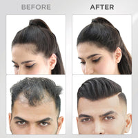 THICK FIBER - Fibers for Thinning Hair & Bald Spots (BLACK, Pack of 2) - 25g Bottle - Conceals Hair Loss in Seconds for Women & Men