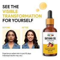 Organix Mantra Batana Oil for Hair & Skin | 100% Pure, Unrefined, Cold Pressed Oil from Honduras | Promotes Hair Growth, Nourishes Scalp & Skin | Natural Moisturizer – 30ML