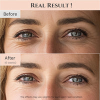 [Beauty of Joseon] Revive Eye Serum with Ginseng & Retinal (30m) | Anti-Aging, Wrinkle Care, Korean Eye Cream for Dark Circles & Fine Lines