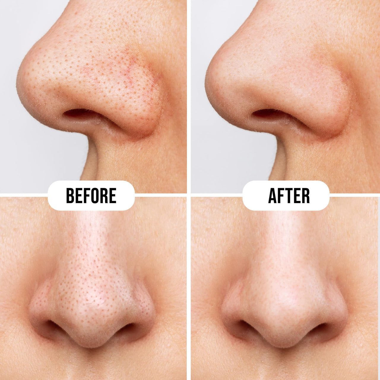 Hilary Rhoda Deep Cleanse Nose Strips | Instant Removal | Removes Blackheads & Whiteheads | Deep Cleanses Skin & Removes Dirt & Oil | 10 Strips (Rose - Shade 02)