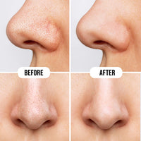 Hilary Rhoda Deep Cleanse Nose Strips | Instant Removal | Removes Blackheads & Whiteheads | Deep Cleanses Skin & Removes Dirt & Oil | 10 Strips (Rose - Shade 02)