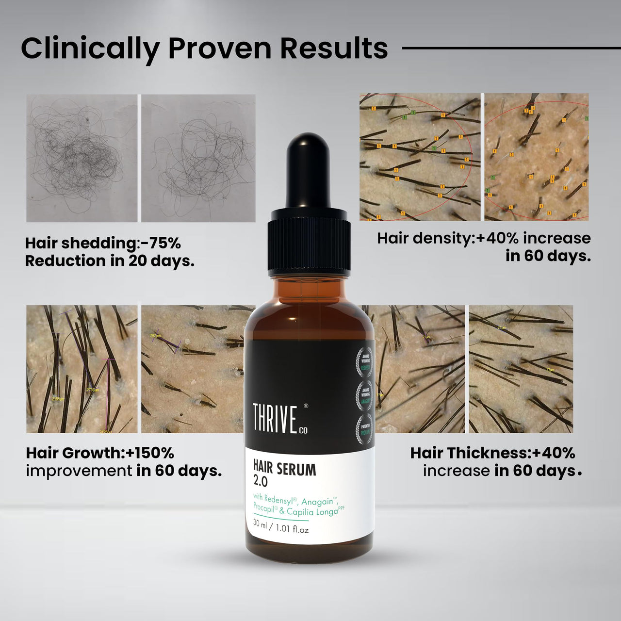 Thriveco Restorative Hair Growth Duo | Hair Growth Serum 2.0 (50ml) + Hair Vitalizing Rosemary Shampoo (250ml) | with Caffeine, Black Castor Oil, Capila Longa Biotin | For Men and Women