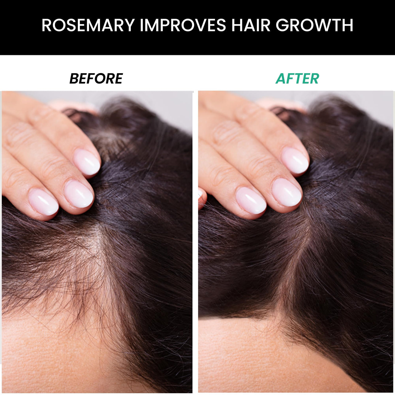 ThriveCo Rosemary Hair Conditioner For Voluminous Hair | Densifying & Stimulating Hair Growth | Promotes Hair Strength | With Pea Peptide & Caffeine | Paraben & Sulfate Free | For Men & Women | 250ml