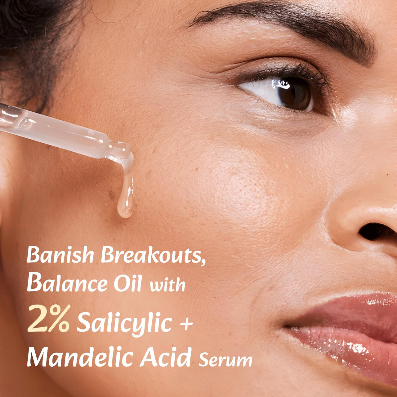 WildOak 2% Salicylic Acid + Mandelic Acid Face Serum | Acne Killer, Blackheads & Excess Oil | Gentle & Great for Sensitive Skin | Pore Cleansing & Skin Exfoliation | For Men & Women | 30ml