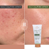 Pure Aatman Tea Tree Deep Pore Cleanser with Neem & Basil | Acne Control, Oil Balance & Skin Purifying facewash| Sulfate-Free, Natural Face Wash for Oily & Acne-Prone Skin
