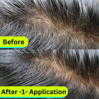 NOX DETOX Anti Dandruff Hair Mask | Overnight Solution for Dry, Itchy, Flaky Scalp | 100% Vegan | Paraben Free