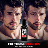 Beardo Beard & Hair Growth Oil, 50ml (Pack of 2) | Natural Hair Oil for Thicker & Longer Beard | Beard Oil for Uneven, Patchy & Fast Beard Growth | Growth Oil for Stronger & Fuller Beard Hair