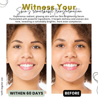 Nature's Kinn Pure Radiance Lightening & Brightening Serum 30 ml | Enhanced with Licorice, Niacinamide, Cactus Stem Cells, and AHA | Free of Alcohol, Sulphates, Parabens, and Phthalates | Hydrating, Skin-Brightening Serum