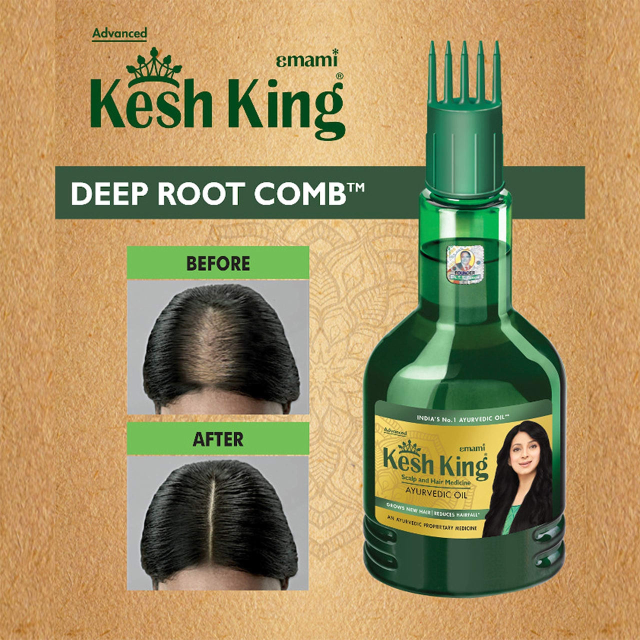 Kesh King Ayurvedic Medicinal Oil, 300Ml,300 Grams