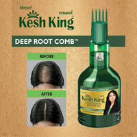 Kesh King Ayurvedic Medicinal Oil, 300Ml,300 Grams
