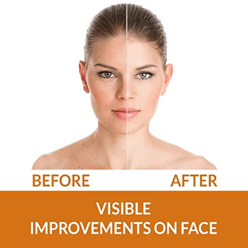 Kelaya Vitamin C Face Cream For Glowing And Radiant Skin Both Women & Men | Vitamin C Cream For Skin Whitening, Brightening And Pigmentation Blended With Vitamin C, Vitamin E, Niacinamide | Vit C Cream for Dry & Oily Skin -50g