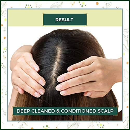 INDUS VALLEY Scalp Conditioner Pack | Beauty Gift Set | Gift for Your Best Friend, Lover, Girlfriend, Wife, on Diwali Gift ,Christmas ,Birthday, Anniversary,New year, Valentine's  Day, Mother's  Day-Gift Pack (30g ,25+5=30ml)