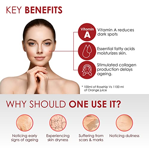 Good Vibes Rose Hip Radiant Glow Face Serum, 10 ml Light Weight Non Greasy Moisturizing Anti Ageing Formula For All Skin Types, Corrects Dark Spots, Natural, No Parabens & Sulphates, No Animal Testing