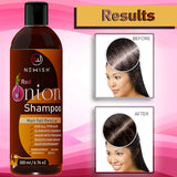 Newish Red Onion Shampoo For Hair Growth and Hairfall Control (Sls & Paraben Free) For Men and Women, 200 ml